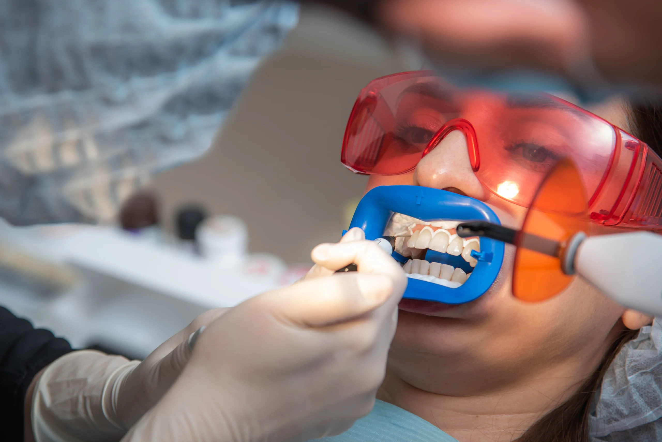 How to Whiten Teeth Safely What Fairfax Patients Should Know Before Starting