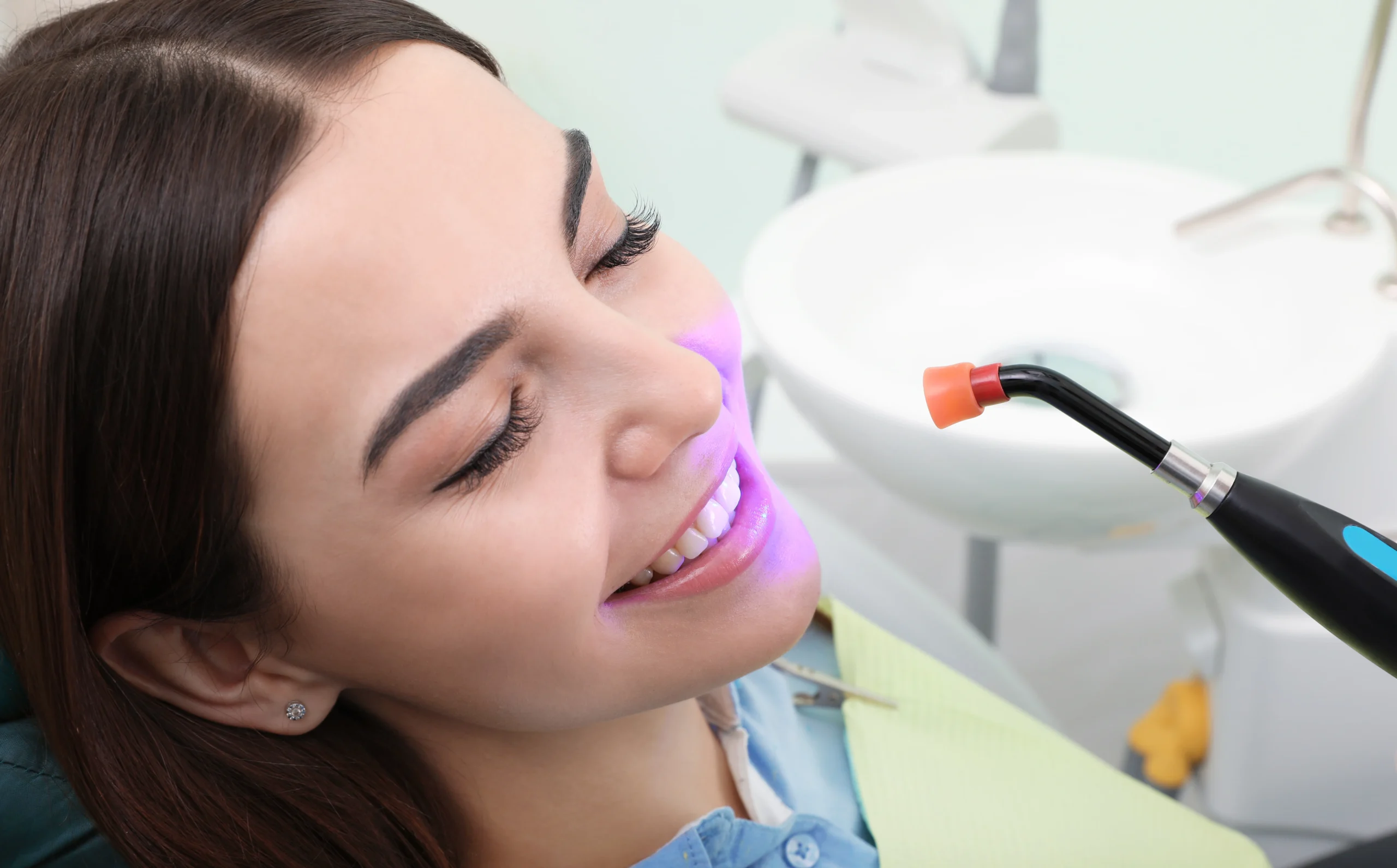 What Is Tooth Bonding and Is It Right for You What Fairfax Patients Should Know